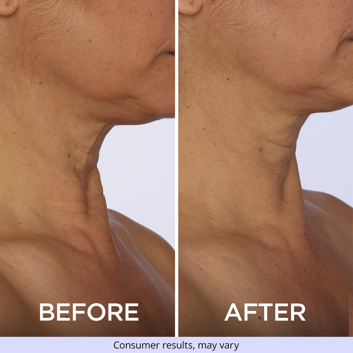 GoPure Tighten & Lift Neck & Chest Moisturizer Cream for Visibly Firming, Tightening and Lifting Wrinkles & Crepey Skin, 1.7oz