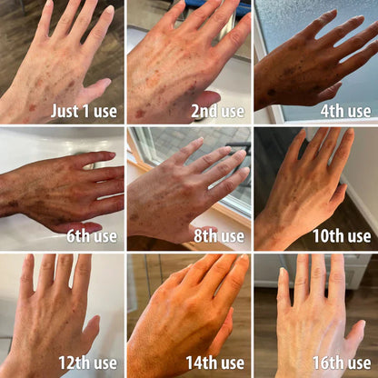 Dark Spot Correcting Glow Serum