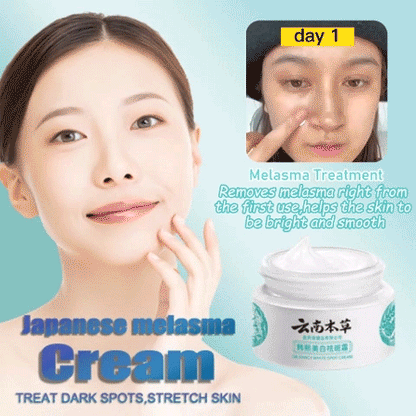 🌿JP.HANCY Yunnan Herbal Whitening and Freckle-Removing Cream: Fades Spots and Brightens Skin Tone 🌟