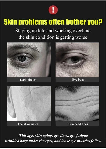 Anti-Aging Wrinkle Cream-(BUY 2 GET 1 FREE🎁BUY 3 GET 2 FREE🎁BUY 5 GET 3 FREE)