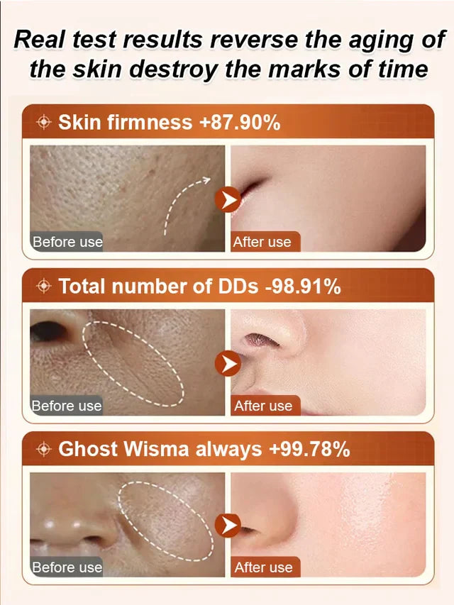 Ecdoin Anti-aging Essence 🔥Buy 2 Get 1 Free🔥 (Free Shipping)