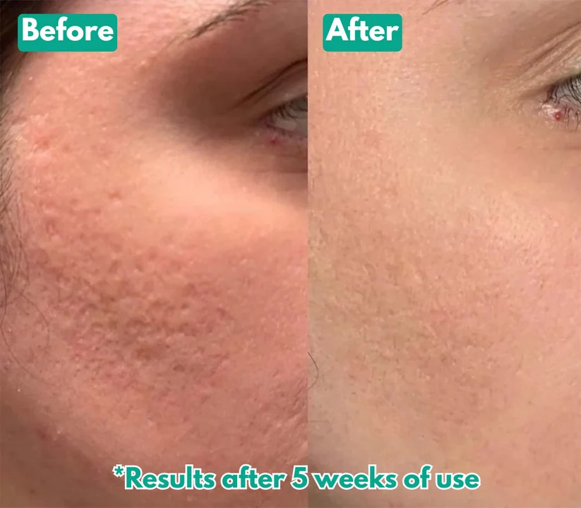 🏆Flash Sale⚡ Microcrystal™ Serum PM Duo