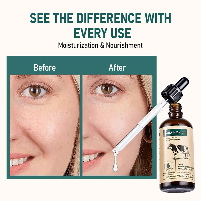 Aussie Betta Gentle Retinol Tallow Serum | Sensitive Skin & Rosacea Safe Anti-Aging | Australian Grass-Fed