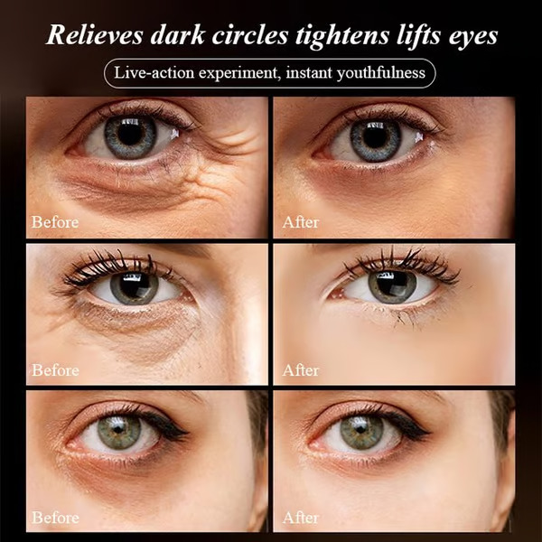 New Retinol Caffeine Anti-Wrinkle Stay Up All Night Eye Cream 🔥Buy 1 Get 1 Free🔥 (Free Shipping)