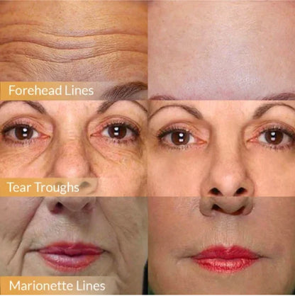 🔥 Buy 1 Get 1 Free🔥POLYPEPTIDE FIRMING FULL FACE CREAM-CHANGE FOR BEAUTIFUL SKIN WITHIN 2 WEEKS