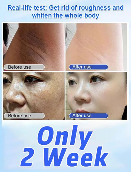 Glycolic Acid Vitamin E Urea Cream for Lightening Spots and Whitening