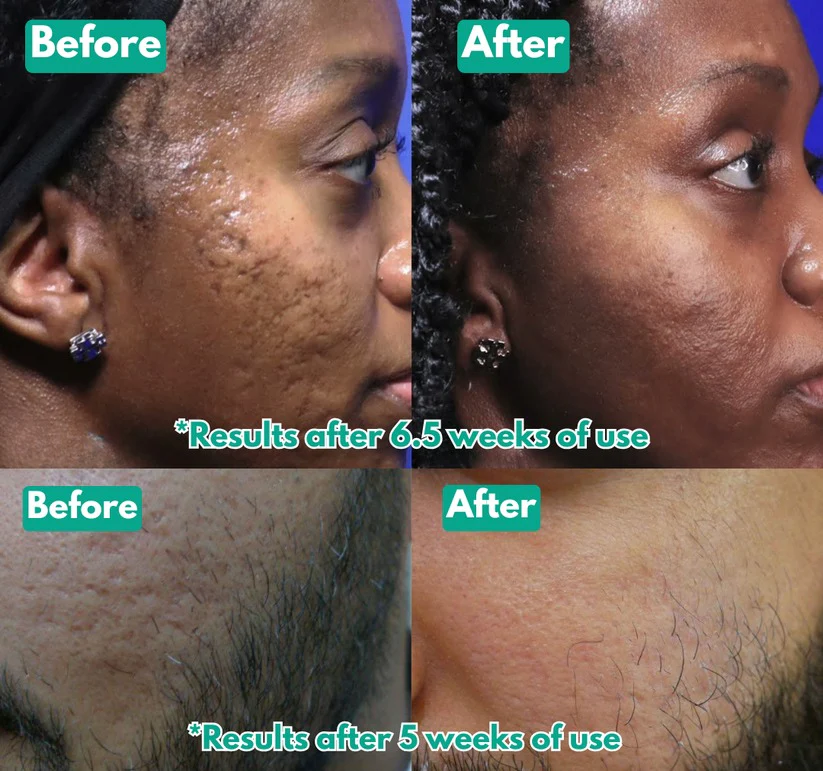 🏆Flash Sale⚡ Microcrystal™ Serum PM Duo