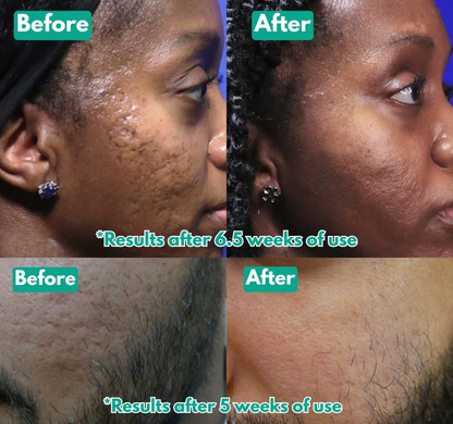 🏆Flash Sale⚡ Microcrystal™ Serum PM Duo