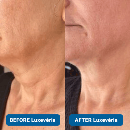 ✨3% Hyaluronic Acid Ultra Hydrating Serum by Luxevéria