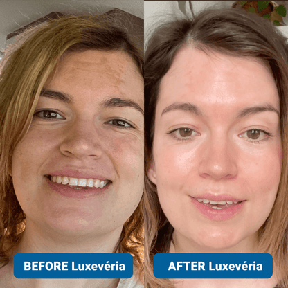 ✨3% Hyaluronic Acid Ultra Hydrating Serum by Luxevéria