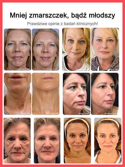 Anti-wrinkle serum with recombinant collagen