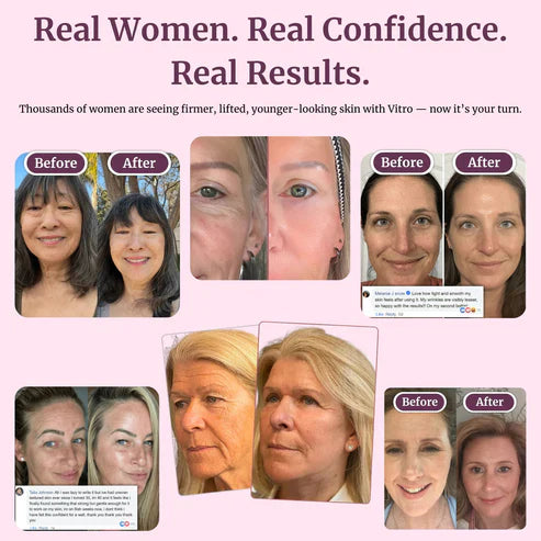 🏆 #1 Bestselling🏆-- Calcium Multi Balm 💫 Anti-Aging & Firming Korean Skincare Stick🔥