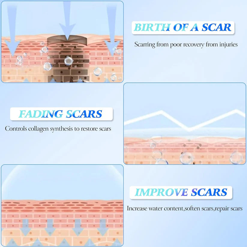 Skin Smoothing Scar Cream, Lighten & Repair All Scars