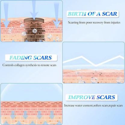 Skin Smoothing Scar Cream, Lighten & Repair All Scars