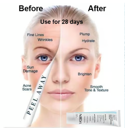 🎉Hot Sale 49% OFF🎉-NIDA Youthful Formula Ultimate Moisturizing Cream