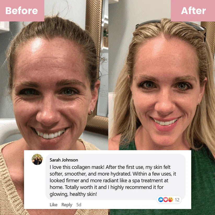 Pamper Yourself — Buy 2 Collagen Night Masks, Get 1 Free! Wake Up to Youthful, Hydrated Skin!