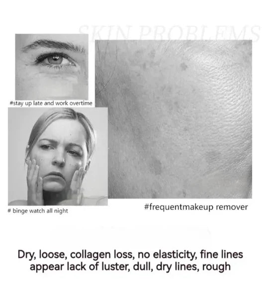 🔥 Buy 1 Get 1 Free🔥POLYPEPTIDE FIRMING FULL FACE CREAM-CHANGE FOR BEAUTIFUL SKIN WITHIN 2 WEEKS