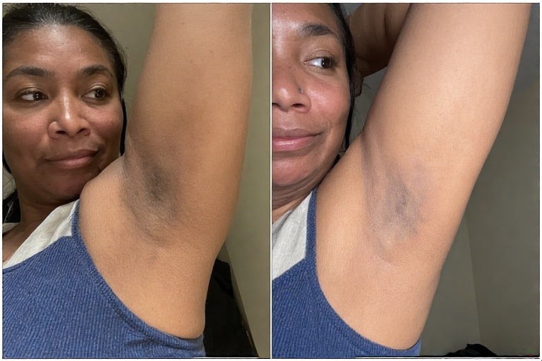 🎉🎉🎉Underarm Brightening Cream✨✨✨
