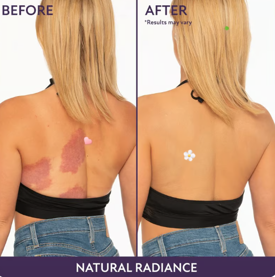 All Over Complexion Perfector