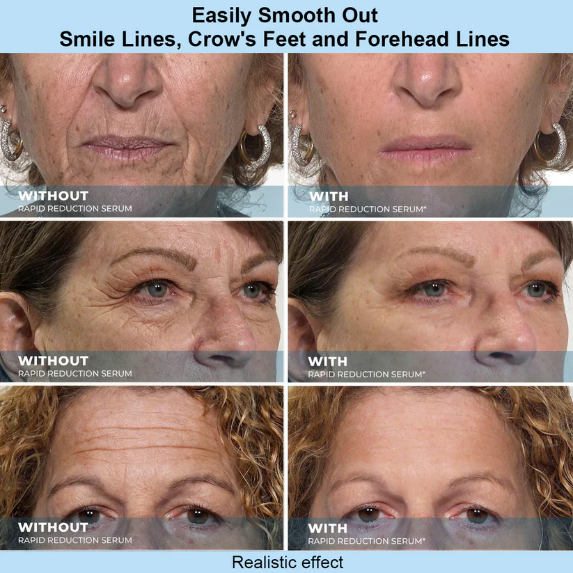Results In 60 Seconds - Lunivéa™ Rapid Wrinkle-Reducing Serum for Wrinkles, Bags & Dark Circles