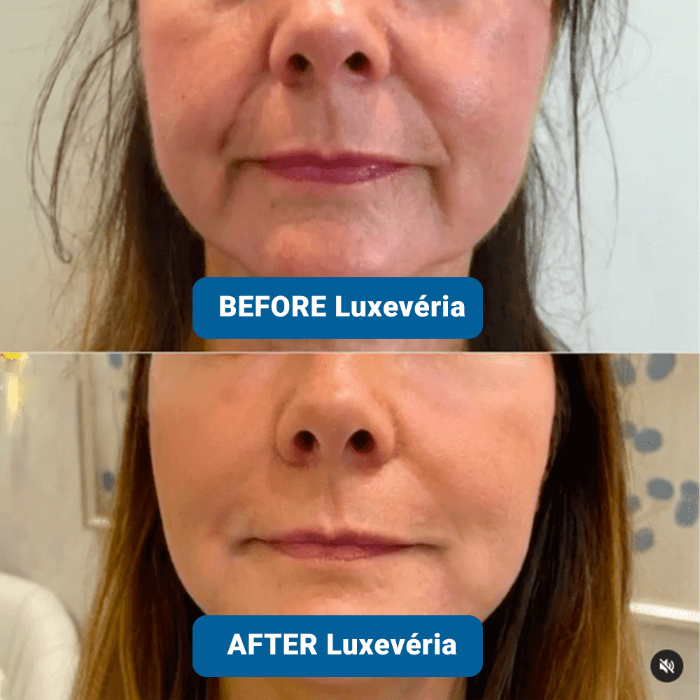 ✨3% Hyaluronic Acid Ultra Hydrating Serum by Luxevéria