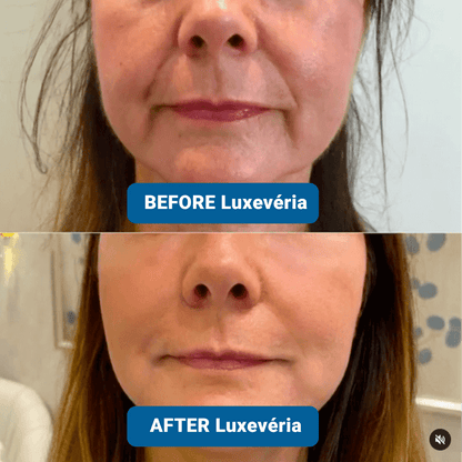 ✨3% Hyaluronic Acid Ultra Hydrating Serum by Luxevéria