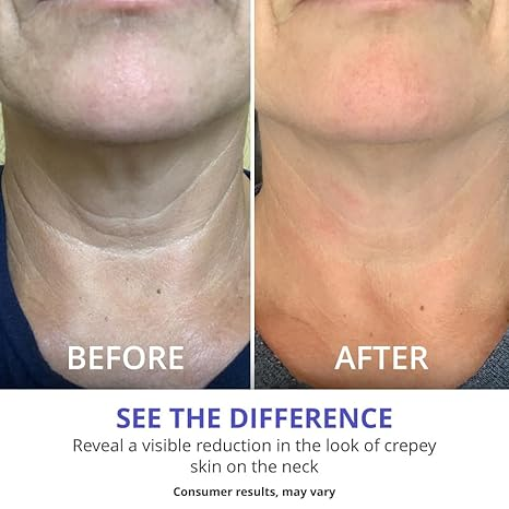GoPure Tighten & Lift Neck & Chest Moisturizer Cream for Visibly Firming, Tightening and Lifting Wrinkles & Crepey Skin, 1.7oz