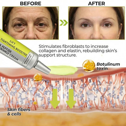 ✨ LAST DAY BUY 1 GET 1 FREE✨Celestvéra: Get Botox-Level Tightening Without the Needle, Stroke Face, or 800 Maintenance!